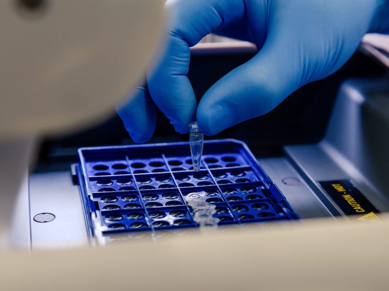 A closeup shot of a laboratory worker arranging pipette tips in a blue container for a coronavirus testing